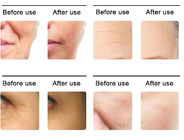RF HIFU Home Use Wrinkle Remover Machine Multifunctional Facial Beauty Vmax