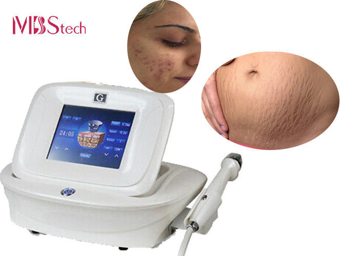 5Mhz Scar Removal Face Lifting Microneedle RF Machine