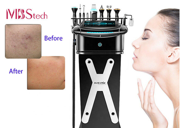 Ice Hammer Face Lift Blackhead Removal Hydro Facial Machines